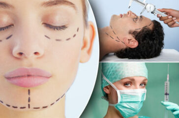 Cosmetic Surgery