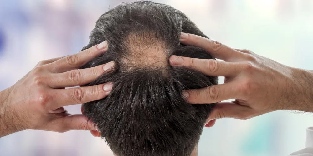 The Benefits of Scalp Massages for Hair Health 