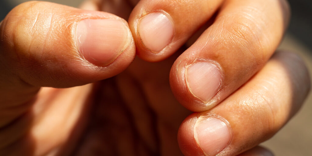 The Connection Between Diet and Nail Health 
