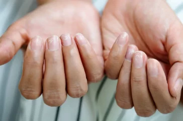 The Connection Between Diet and Nail Health