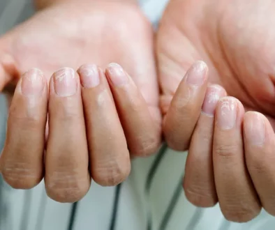 The Connection Between Diet and Nail Health
